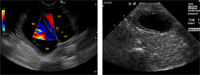 A pair of images showing the same ultrasound image.