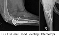 CBLO (Cora Based Leveling Osteotomy)