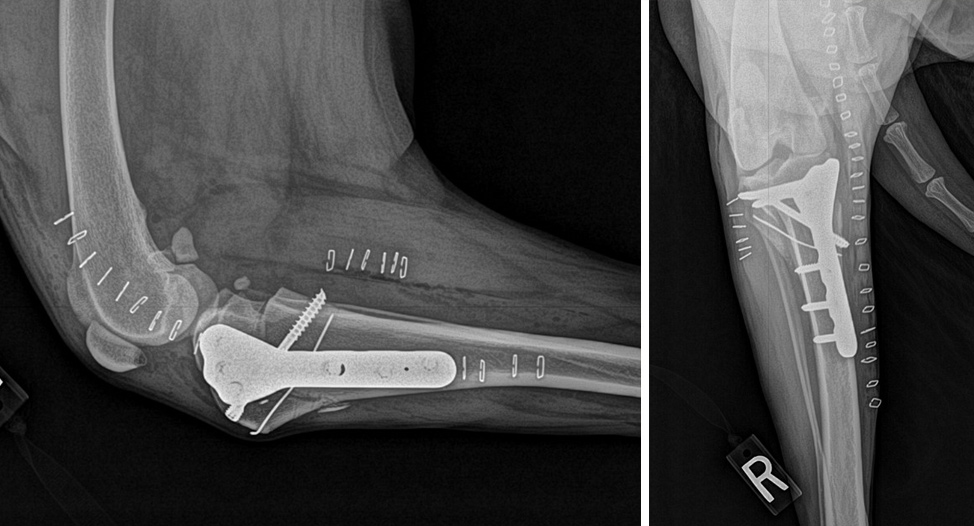 A picture of an x-ray and the image shows the foot.