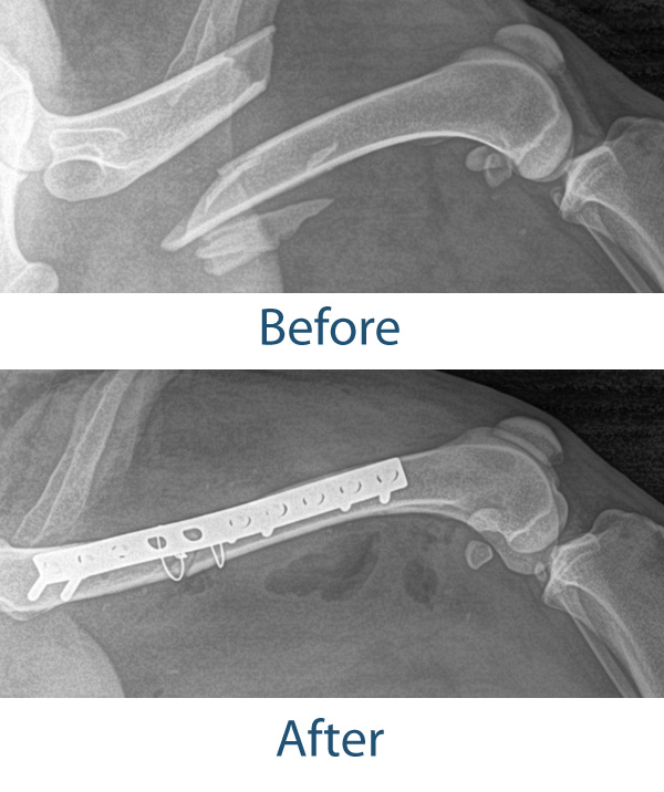 A picture of the x-rays before and after surgery.